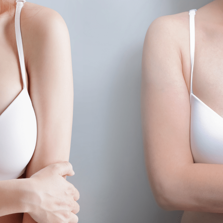 non surgical ways to reduce areola